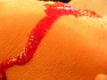Blood