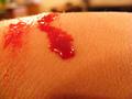 Blood