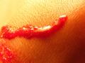 Blood