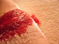 Blood