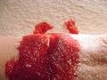Blood