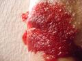Blood