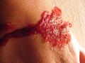 Blood