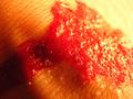 Blood