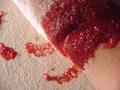 Blood